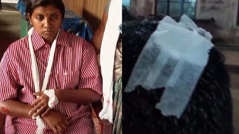 വിവാഹച്ചടങ്ങില്‍ പങ്കെടുത്ത് മടങ്ങിയവരെ പൊലീസ് മര്‍ദ്ദിച്ചു; ലാത്തിചാര്‍ജ്, സ്ത്രീയുടെ തോളെല്ലിന് പരിക്ക്