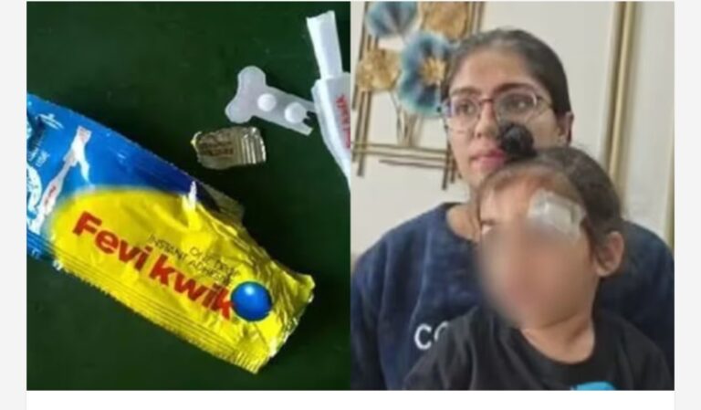 കുട്ടിയുടെ തലയിലെ മുറിവ് തുന്നിക്കെട്ടുന്നതിന് പകരം ഫെവിക്വിക്ക് ഉപയോഗിച്ച് ഒട്ടിച്ച് ഡോക്ടർമാർ; പരാതിയുമായി മാതാപിതാക്കൾ, സംഭവം ഉത്തർപ്രദേശിൽ