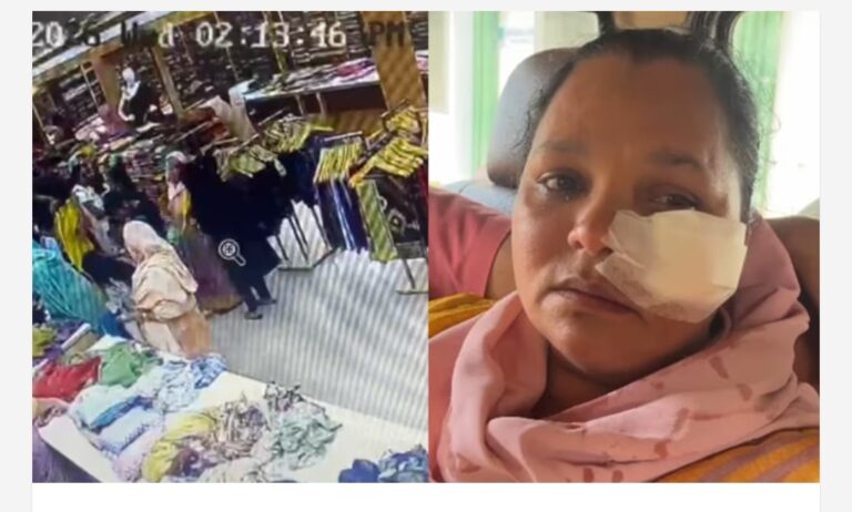 മകനുമായുള്ള പ്രണയബന്ധത്തെ ചൊല്ലിയുള്ള പ്രശ്നം, ടെക്സ്റ്റൈൽസിൽ ജീവനക്കാരിക്ക് നേരെ ആക്രമണം; കറിക്കത്തി ഉപയോഗിച്ച് മുഖത്ത് കുത്തി പരിക്കേൽപ്പിച്ച് 19കാരി